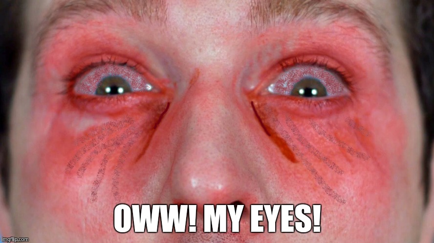 OWW! MY EYES! | OWW! MY EYES! | image tagged in jesse and mike | made w/ Imgflip meme maker