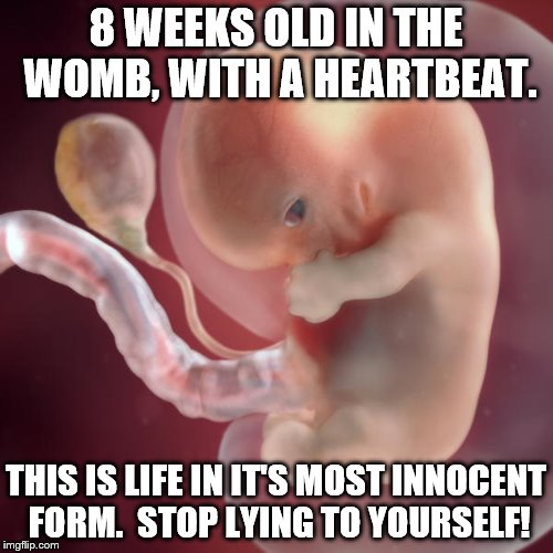 8 WEEKS OLD IN THE WOMB, WITH A HEARTBEAT. THIS IS LIFE IN IT'S MOST INNOCENT FORM.  STOP LYING TO YOURSELF! | made w/ Imgflip meme maker