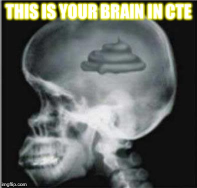 Shit for brains | THIS IS YOUR BRAIN IN CTE | image tagged in shit for brains | made w/ Imgflip meme maker