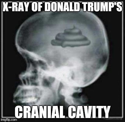 Xrodtcc | X-RAY OF DONALD TRUMP'S; CRANIAL CAVITY | image tagged in xray,donald trump,trump,presidential debate,politics,political humor | made w/ Imgflip meme maker