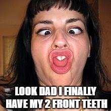 stupid people be like |  LOOK DAD I FINALLY HAVE MY 2 FRONT TEETH | image tagged in stupid people be like | made w/ Imgflip meme maker