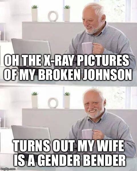Hide the Pain Harold Meme | OH THE X-RAY PICTURES OF MY BROKEN JOHNSON; TURNS OUT MY WIFE IS A GENDER BENDER | image tagged in memes,hide the pain harold | made w/ Imgflip meme maker