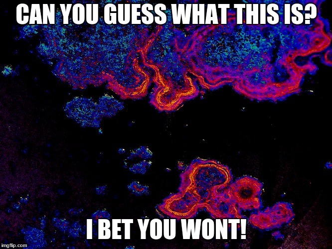 It's not what it looks like! i guerentee | CAN YOU GUESS WHAT THIS IS? I BET YOU WONT! | image tagged in trippy | made w/ Imgflip meme maker