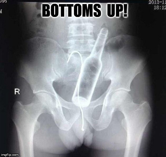 Bottoms Up! |  BOTTOMS  UP! | image tagged in beer bottle,beer,ass,rectum | made w/ Imgflip meme maker