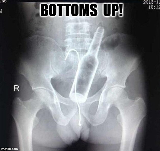 Bottoms Up! | BOTTOMS  UP! | image tagged in beer bottle,beer,ass,rectum | made w/ Imgflip meme maker