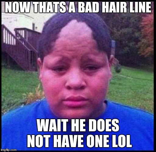 no hair line | NOW THATS A BAD HAIR LINE; WAIT HE DOES NOT HAVE ONE LOL | image tagged in memes | made w/ Imgflip meme maker