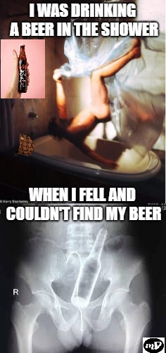 I WAS DRINKING A BEER IN THE SHOWER; WHEN I FELL AND COULDN'T FIND MY BEER | image tagged in emergency,beer,dark humor,nurses | made w/ Imgflip meme maker