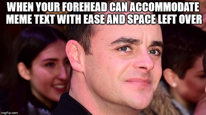 WHEN YOUR FOREHEAD CAN ACCOMMODATE MEME TEXT WITH EASE AND SPACE LEFT OVER | image tagged in uk,england,celebrity,memes | made w/ Imgflip meme maker