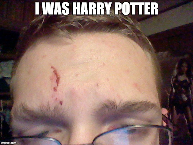 I Scratched Myself  | I WAS HARRY POTTER | image tagged in harry potter,injury | made w/ Imgflip meme maker
