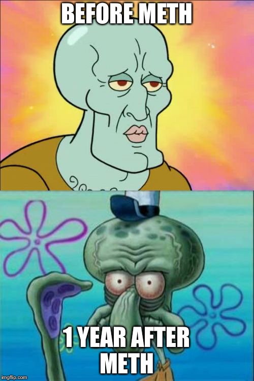 Squidward | BEFORE METH; 1 YEAR AFTER METH | image tagged in memes,squidward | made w/ Imgflip meme maker