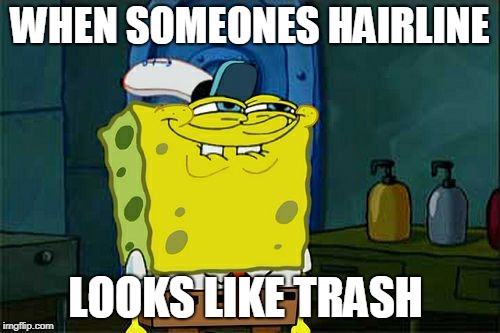 Don't You Squidward Meme | WHEN SOMEONES HAIRLINE; LOOKS LIKE TRASH | image tagged in memes,dont you squidward | made w/ Imgflip meme maker