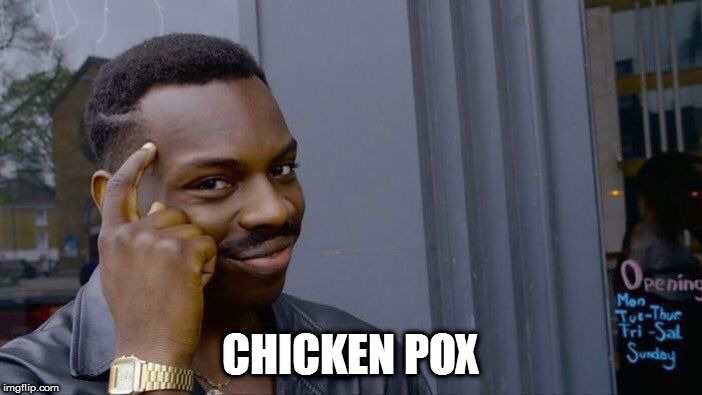 Roll Safe Think About It Meme | CHICKEN POX | image tagged in memes,roll safe think about it | made w/ Imgflip meme maker