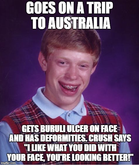 Bad Luck Brian Meme | GOES ON A TRIP TO AUSTRALIA; GETS BURULI ULCER ON FACE AND HAS DEFORMITIES. CRUSH SAYS "I LIKE WHAT YOU DID WITH YOUR FACE, YOU'RE LOOKING BETTER!" | image tagged in memes,bad luck brian | made w/ Imgflip meme maker