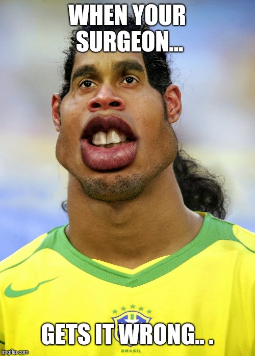 Image tagged in ronaldinho when plastic surgery goes wrong