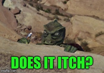DOES IT ITCH? | made w/ Imgflip meme maker