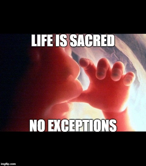 Abortion | LIFE IS SACRED; NO EXCEPTIONS | image tagged in abortion | made w/ Imgflip meme maker