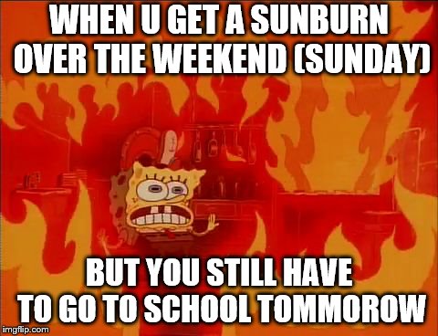 Burning Spongebob | WHEN U GET A SUNBURN OVER THE WEEKEND (SUNDAY); BUT YOU STILL HAVE TO GO TO SCHOOL TOMMOROW | image tagged in burning spongebob | made w/ Imgflip meme maker