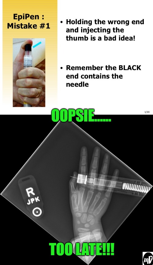 OOPSIE...... TOO LATE!!! | image tagged in allergies,medical,dark humor,mistake | made w/ Imgflip meme maker