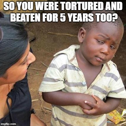 Third World Skeptical Kid Meme | SO YOU WERE TORTURED AND BEATEN FOR 5 YEARS TOO? | image tagged in memes,third world skeptical kid | made w/ Imgflip meme maker
