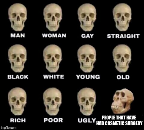 Yep, thats some crazy nosejob ya got there punk | PEOPLE THAT HAVE HAD COSMETIC SURGERY | image tagged in idiot skull,plastic surgery,surgery,memes,nose,man woman gay straight skull | made w/ Imgflip meme maker