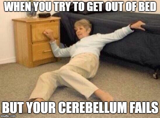 woman falling in shock | WHEN YOU TRY TO GET OUT OF BED; BUT YOUR CEREBELLUM FAILS | image tagged in woman falling in shock | made w/ Imgflip meme maker