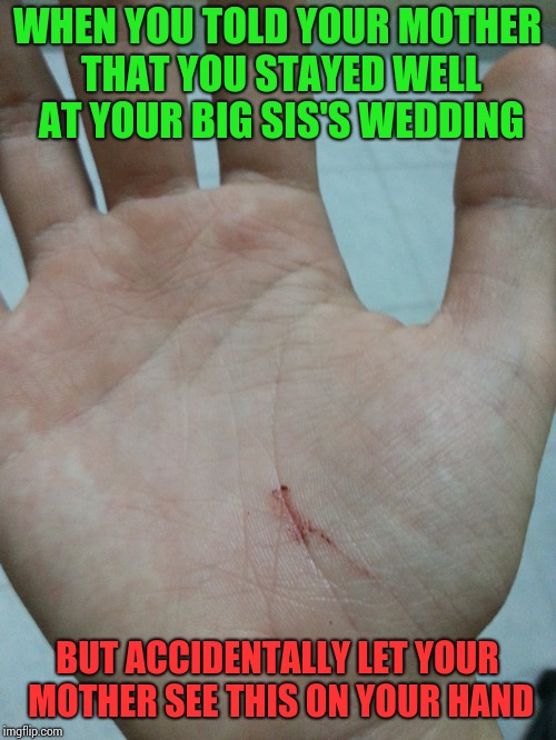 And your face..your leg too.But mom, they started it. | WHEN YOU TOLD YOUR MOTHER THAT YOU STAYED WELL AT YOUR BIG SIS'S WEDDING; BUT ACCIDENTALLY LET YOUR MOTHER SEE THIS ON YOUR HAND | image tagged in mother,wedding,fighting,accident,injury | made w/ Imgflip meme maker
