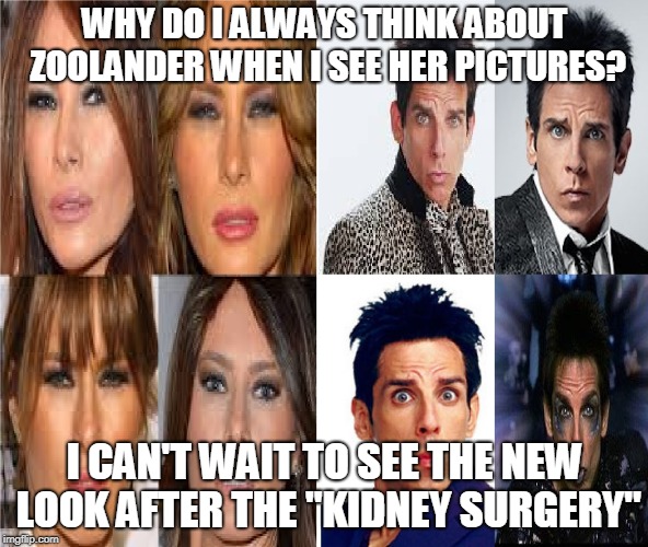 WHY DO I ALWAYS THINK ABOUT ZOOLANDER WHEN I SEE HER PICTURES? I CAN'T WAIT TO SEE THE NEW LOOK AFTER THE "KIDNEY SURGERY" | made w/ Imgflip meme maker