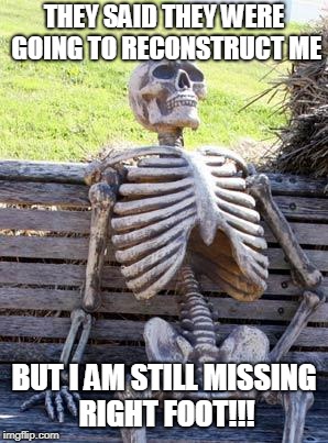 Waiting Skeleton Meme | THEY SAID THEY WERE GOING TO RECONSTRUCT ME; BUT I AM STILL MISSING RIGHT FOOT!!! | image tagged in memes,waiting skeleton | made w/ Imgflip meme maker