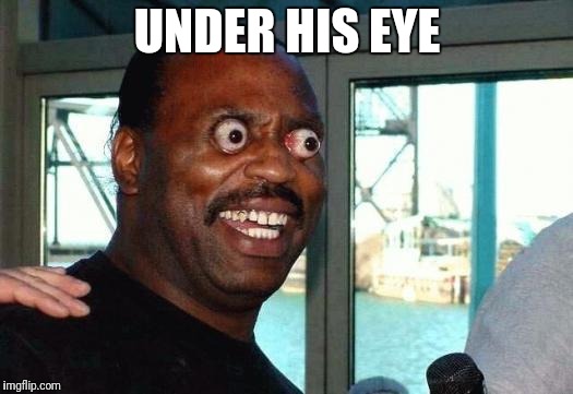 Bug Eyes | UNDER HIS EYE | image tagged in bug eyes | made w/ Imgflip meme maker