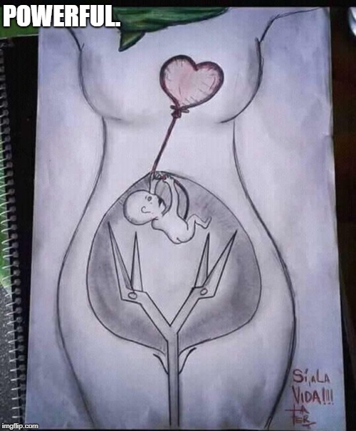 This: | POWERFUL. | image tagged in abortion is murder,abortion,not your body,sad baby,scared baby | made w/ Imgflip meme maker