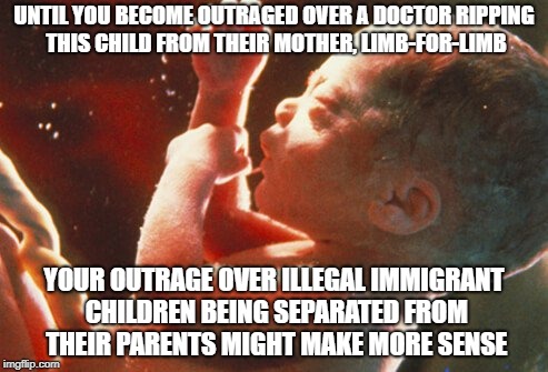 UNTIL YOU BECOME OUTRAGED OVER A DOCTOR RIPPING THIS CHILD FROM THEIR MOTHER, LIMB-FOR-LIMB; YOUR OUTRAGE OVER ILLEGAL IMMIGRANT CHILDREN BEING SEPARATED FROM THEIR PARENTS MIGHT MAKE MORE SENSE | image tagged in memes,abortion,immigrant children,illegal immigration,illegal aliens,liberals | made w/ Imgflip meme maker