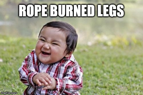 Evil Toddler Meme | ROPE BURNED LEGS | image tagged in memes,evil toddler | made w/ Imgflip meme maker