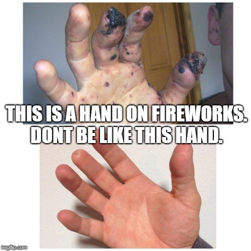 THIS IS A HAND ON FIREWORKS. DONT BE LIKE THIS HAND. | image tagged in fireworks,4th of july | made w/ Imgflip meme maker