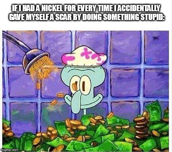"Scars are not a price for long life, but evidence of a lively one." | IF I HAD A NICKEL FOR EVERY TIME I ACCIDENTALLY GAVE MYSELF A SCAR BY DOING SOMETHING STUPID: | image tagged in memes,squidward,bathing in money | made w/ Imgflip meme maker