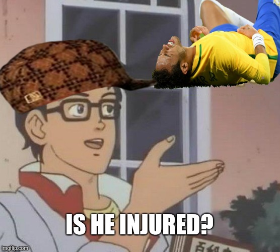 Is This A Pigeon Meme | IS HE INJURED? | image tagged in memes,is this a pigeon,scumbag | made w/ Imgflip meme maker