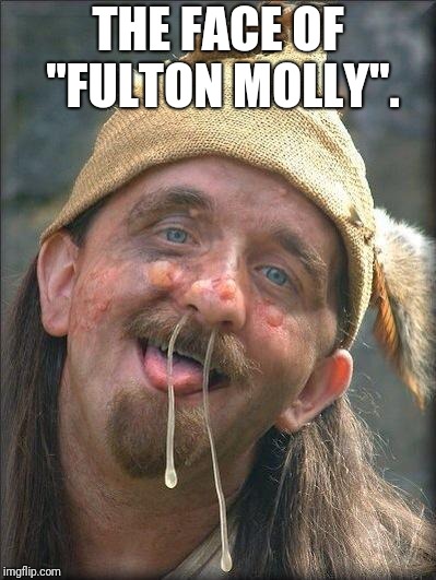 ugly old man | THE FACE OF "FULTON MOLLY". | image tagged in ugly old man | made w/ Imgflip meme maker