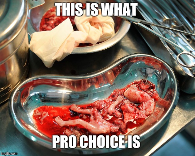 This is what pro choice means  | THIS IS WHAT; PRO CHOICE IS | image tagged in abortion,abortion is murder,pro choice,pro life,murder,real life | made w/ Imgflip meme maker