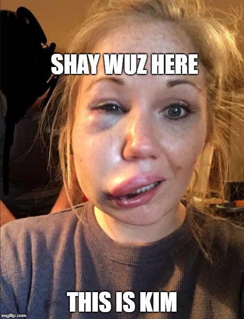 beat up girl | SHAY WUZ HERE; THIS IS KIM | image tagged in beat up girl | made w/ Imgflip meme maker