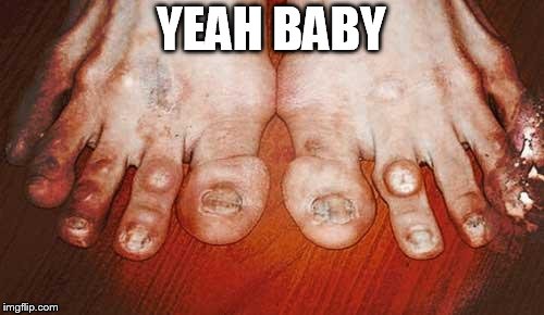 Ugly Feet | YEAH BABY | image tagged in ugly feet | made w/ Imgflip meme maker