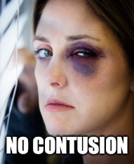 black eye | NO CONTUSION | image tagged in black eye | made w/ Imgflip meme maker