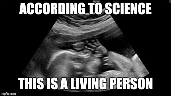 According to science... |  ACCORDING TO SCIENCE; THIS IS A LIVING PERSON | image tagged in memes,science,ultrasound,living person | made w/ Imgflip meme maker