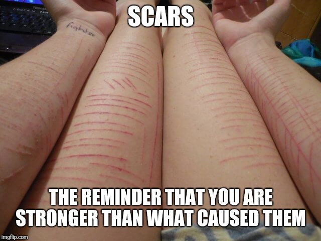 SCARS; THE REMINDER THAT YOU ARE STRONGER THAN WHAT CAUSED THEM | image tagged in scars,memes | made w/ Imgflip meme maker