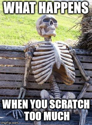 Waiting Skeleton Meme | WHAT HAPPENS WHEN YOU SCRATCH TOO MUCH | image tagged in memes,waiting skeleton | made w/ Imgflip meme maker