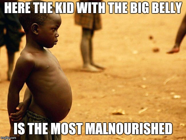 Belly Fat | OO | image tagged in malnourshied | made w/ Imgflip meme maker
