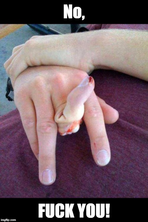 broken finger | No, FUCK YOU! | image tagged in broken finger | made w/ Imgflip meme maker
