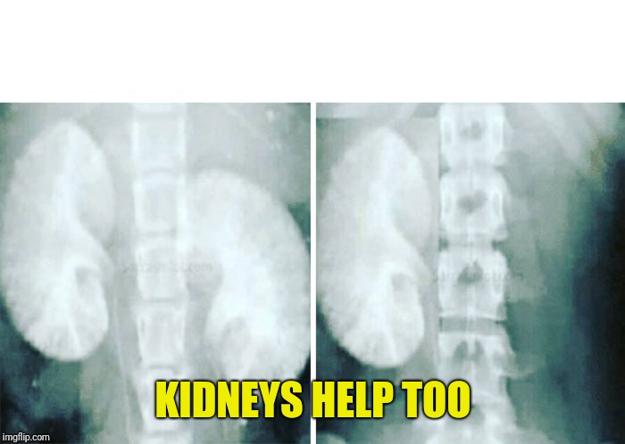 kidney x-ray before after | KIDNEYS HELP TOO | image tagged in kidney x-ray before after | made w/ Imgflip meme maker