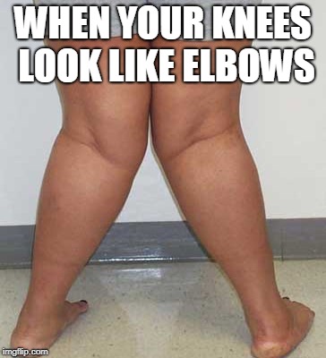 WHEN YOUR KNEES LOOK LIKE ELBOWS | image tagged in knees | made w/ Imgflip meme maker