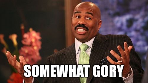 SOMEWHAT GORY | image tagged in memes,steve harvey | made w/ Imgflip meme maker