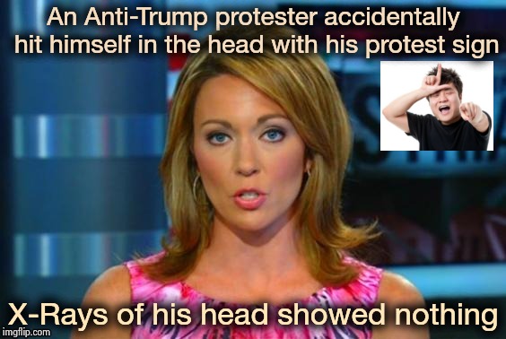 Real News Network | An Anti-Trump protester accidentally hit himself in the head with his protest sign X-Rays of his head showed nothing | image tagged in real news network | made w/ Imgflip meme maker
