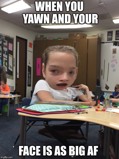 Taryn | WHEN YOU YAWN AND YOUR; FACE IS AS BIG AF | image tagged in first world problems | made w/ Imgflip meme maker